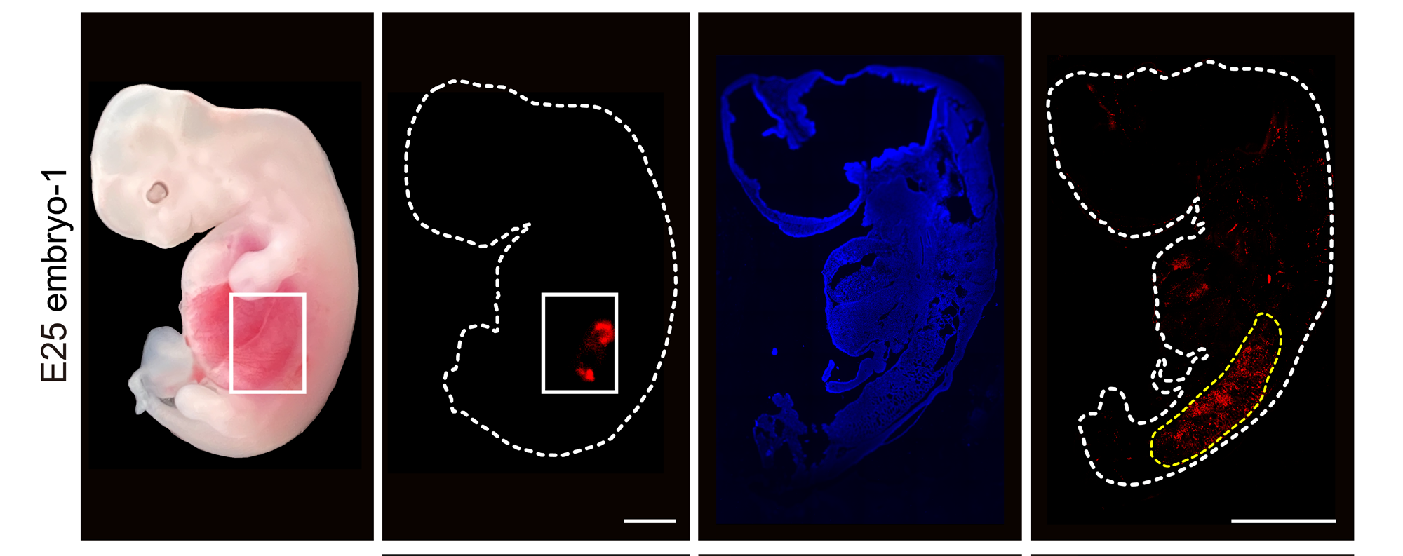 Part-human, part-pig kidneys grown in pig embryos for the first time