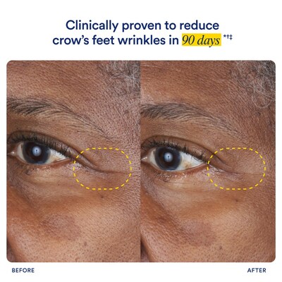 Clinical Trial Proves Ritual's HyaCera Reduces Fine Lines and Wrinkles in 90 Days