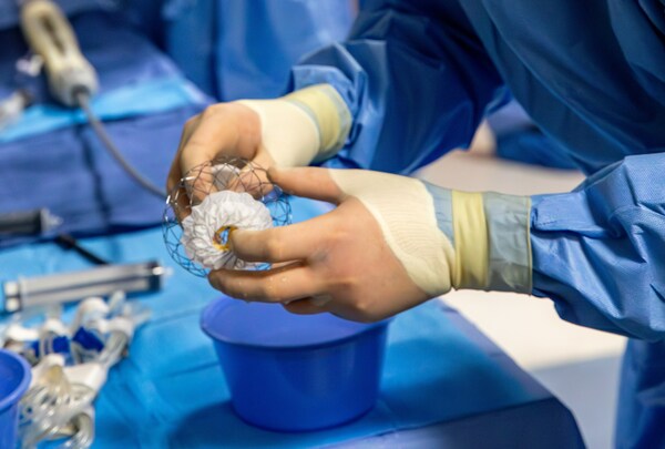 Tampa General Hospital Is the First and Only in the Southeast to Complete Transcatheter Mitral Valve Replacement (TMVR) with AltaValve Technology