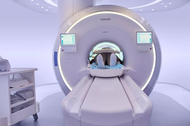 FDA clears Philips AI for making CT-like images from head and neck MRI scans