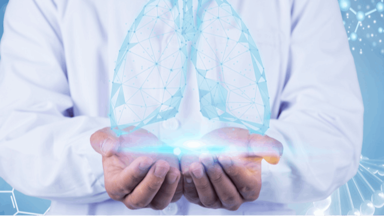 Iovance Biotherapeutics Announces Clinical Program Update for LN-145 in Non-Small Cell Lung Cancer