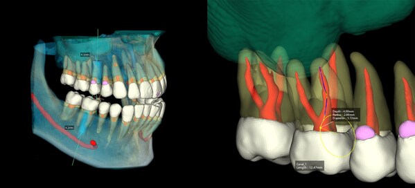 Vatech Enhances AI in Dental Diagnostic Solutions