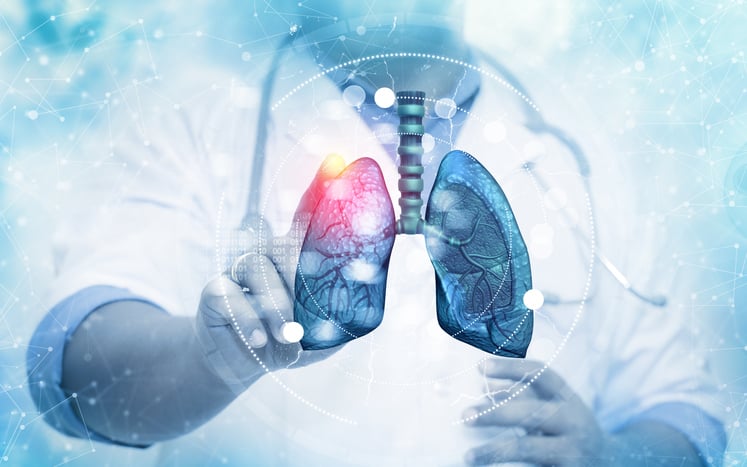 AstraZeneca execs 'not worried' after IL-33 drug fails to improve COPD breathing in phase 2