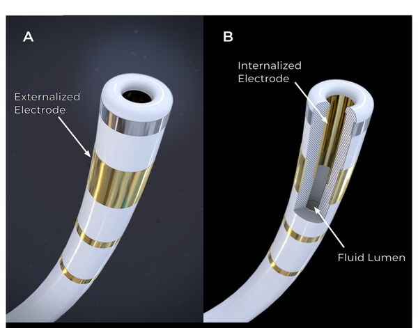 Field Medical Announces First-in-Human Trials for Groundbreaking FieldForce™ Ventricular Pulsed Field Ablation Technology