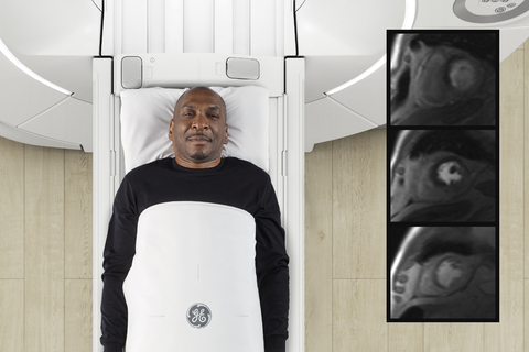 GE HealthCare Expands Contrast Media Portfolio with Launch of MRI Agent Pixxoscan (gadobutrol)