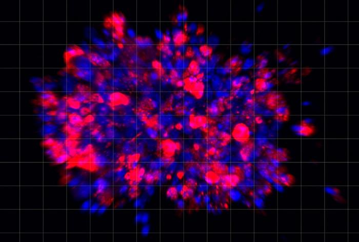 Old heart drug halts growth of pancreatic cancer in organoid and mouse models