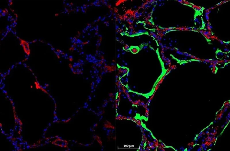 University of Sydney discovers new protein that hinders Covid-19