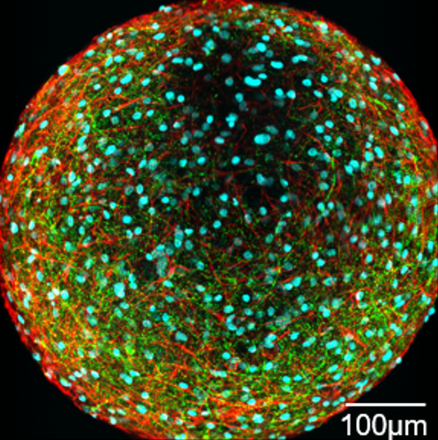 Organoids touted as future of brain disorder R&D as AxoSim scoops up tech from Vyant subsidiary