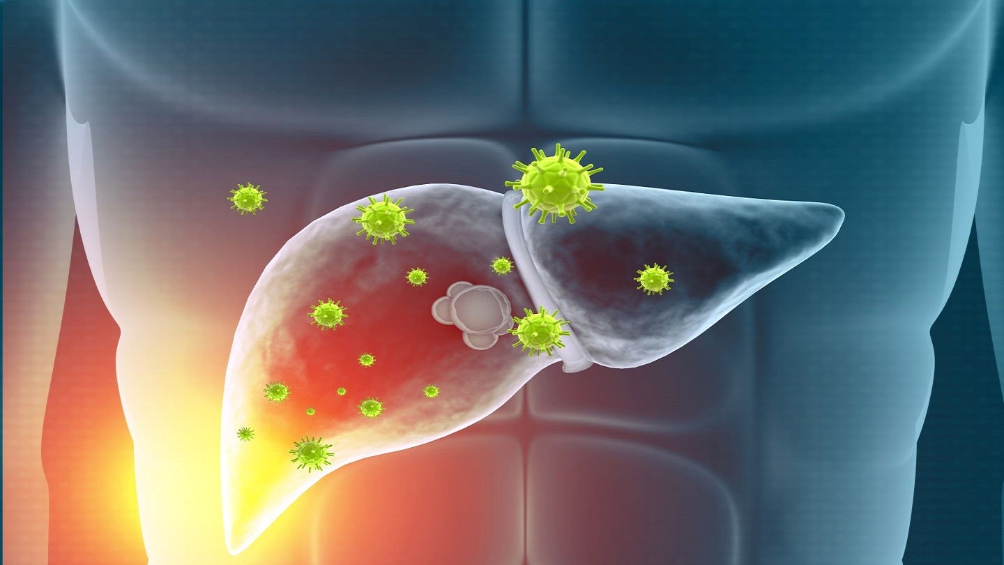 Nuvectis receives orphan drug designation for cholangiocarcinoma therapy