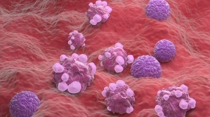 FDA approves MSD’s KEYTRUDA for advanced endometrial cancer