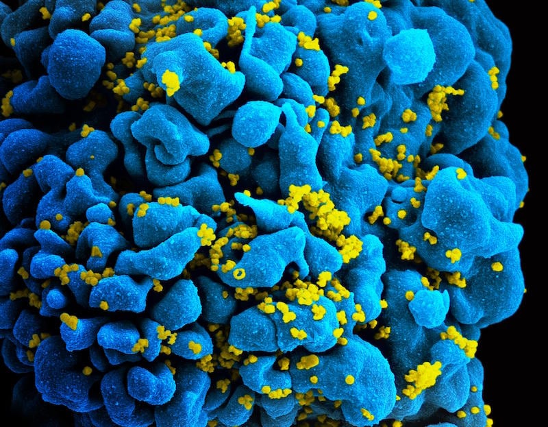 A protein inhibited by GSK's Rukobia could be culprit behind HIV comorbidities, study suggests