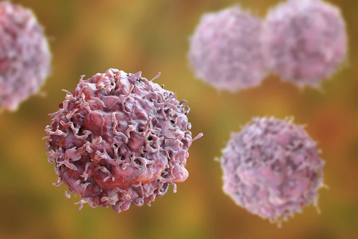 3-drug combo leads to 'unprecedented' response in pancreatic cancer models