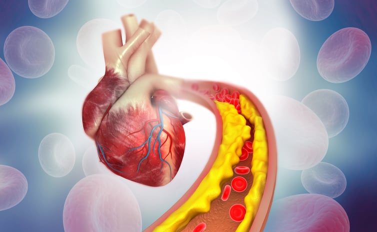 From cancer to cardiovascular disease, AstraZeneca oncology hopeful could slow atherosclerosis