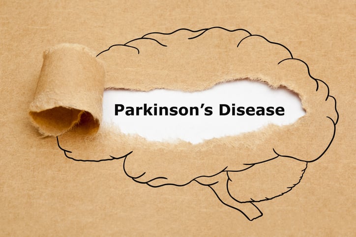 AbbVie's Duopa successor in Parkinson's rejected again after FDA flags 3rd-party manufacturer issues