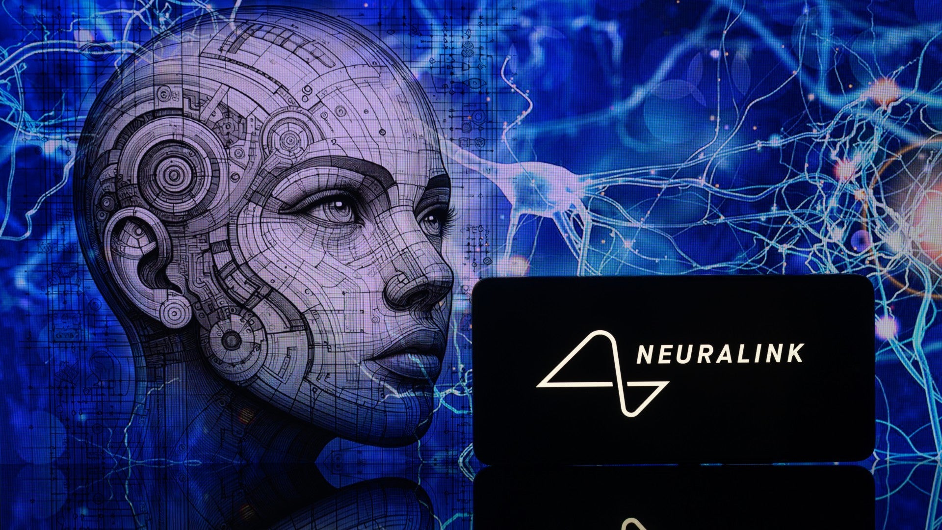 Can Musk’s BCI company Neuralink be trusted to put chips in your brain?